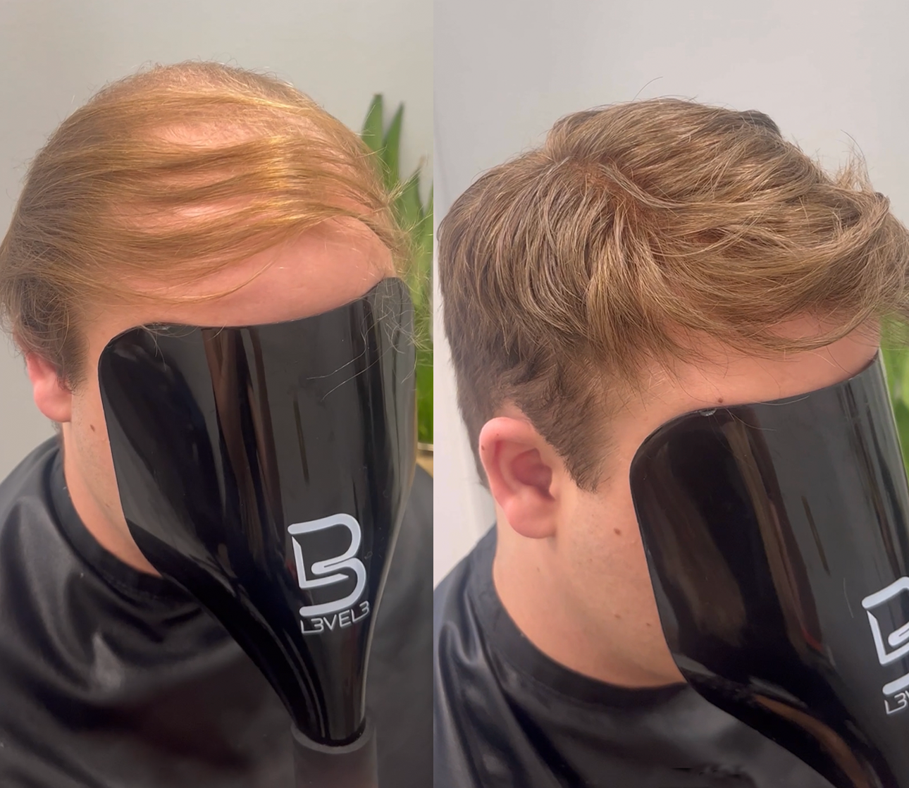 Men's hair system transformation from thinning hair to a curly style in Huntersville