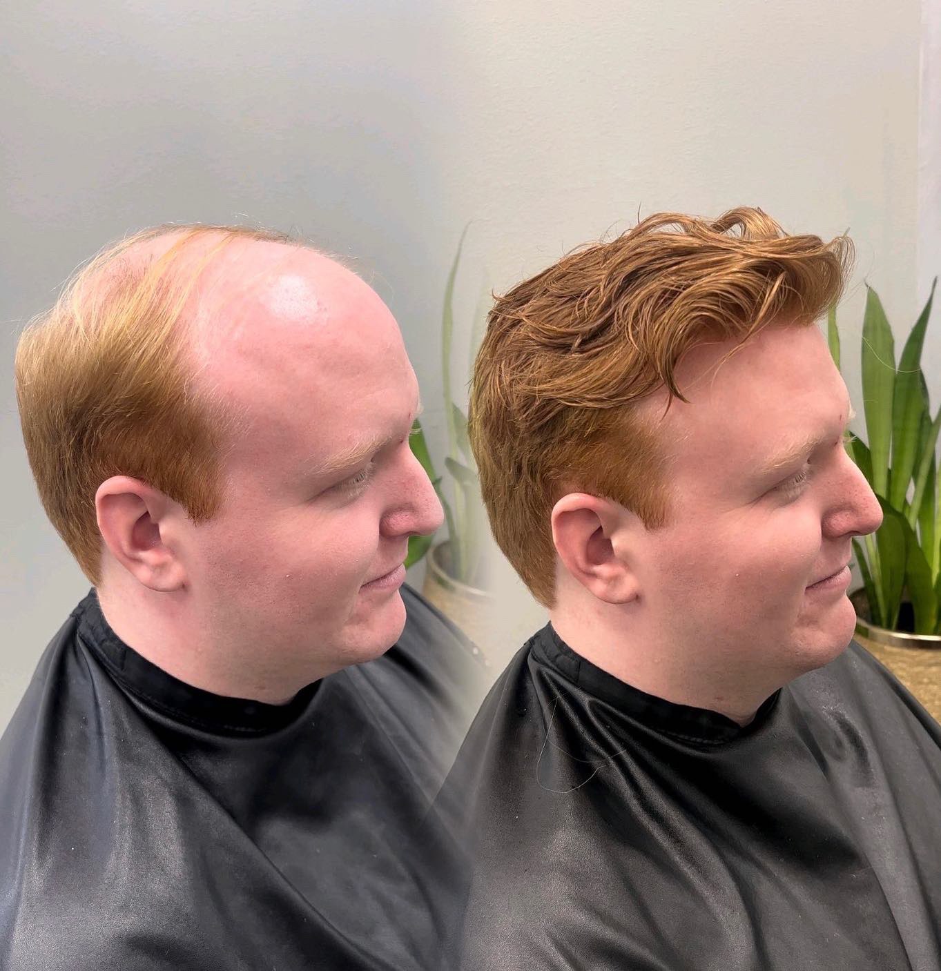 Red-haired client hair system before-and-after result in Huntersville, North Carolina