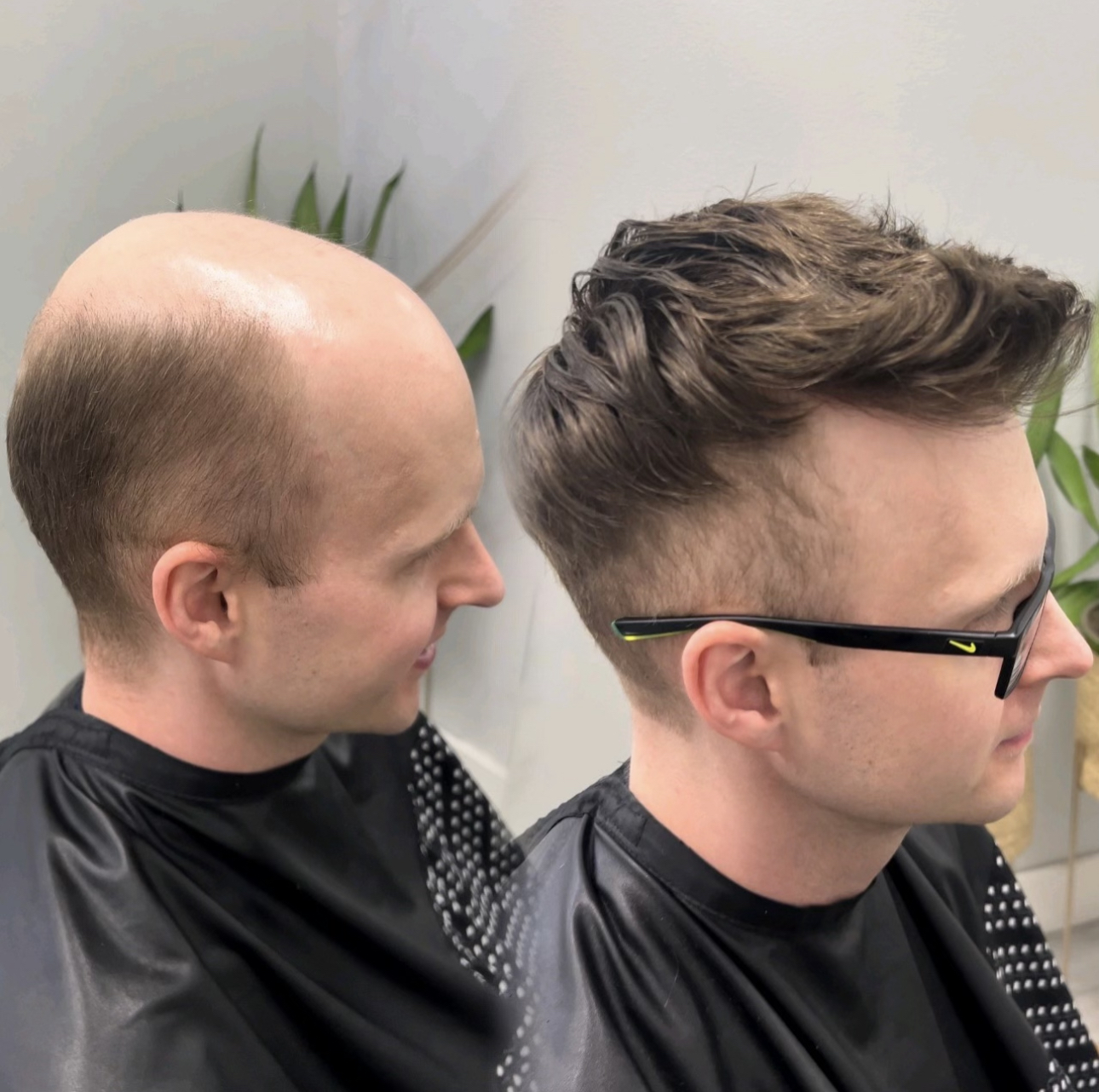 Before-and-after custom hair system result for a client in Huntersville, North Carolina